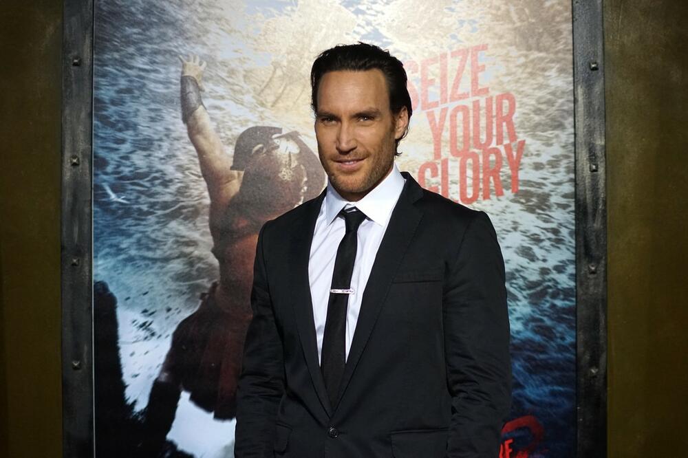 ŽENE I DALJE LUDE ZA NJIM! REKONSTRUISALI SU MU LICE I UGRADILI 17 TITANIJUMSKIH PLOČA: I dalje mami uzdahe mnogih!