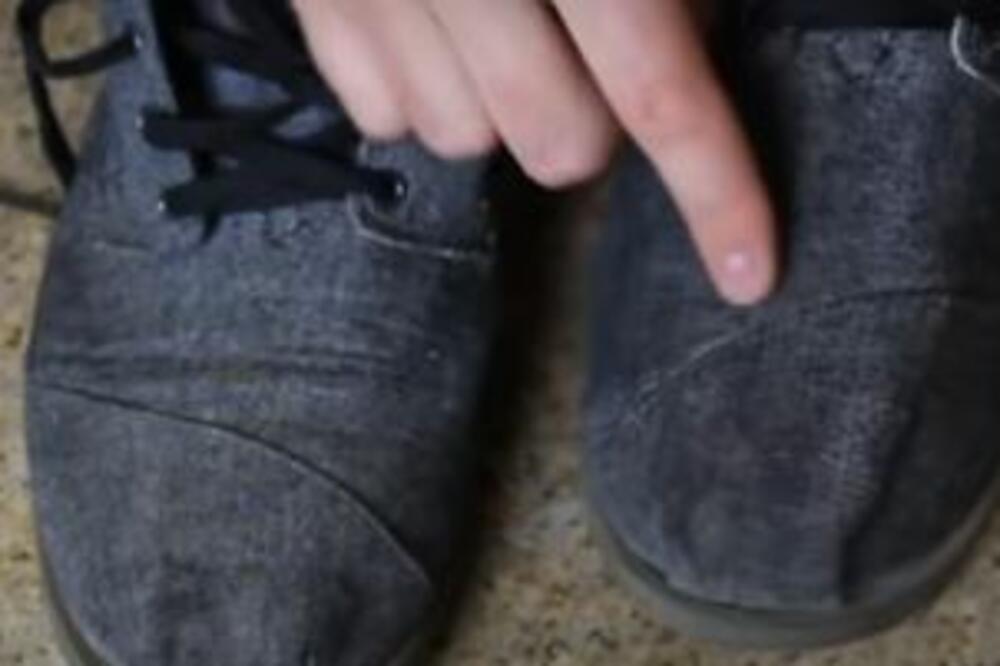 PATIKE MOGU OSTATI SUVE I KADA JE KIŠA: Kako? Postoji sjajan trik, problem rešen u par koraka! (VIDEO)