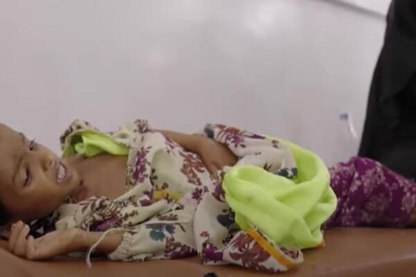 PAKAO NA ZEMLJI: Bolnica u kojoj izgube 12 mališana mesečno, Jemen UMIRE OD GLADI!