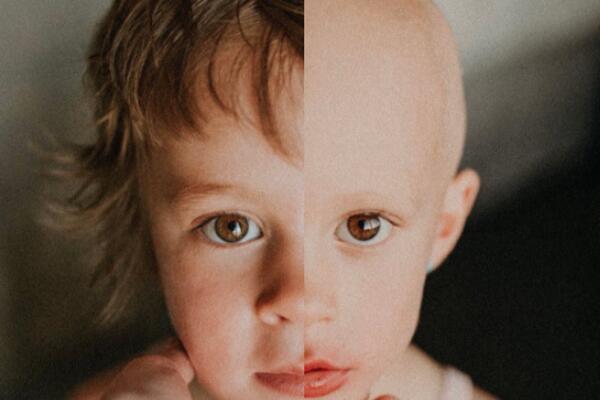 SRCEPARAJUĆE FOTOGRAFIJE KOJE SVEDOČE O BORBI DEVOJČICE SA RAKOM: Borila se poput ŠAMPIONA (FOTO)