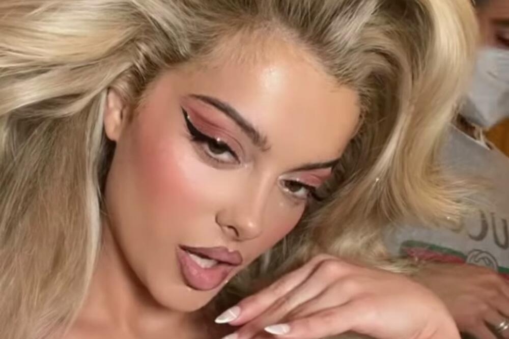 IZGLEDA LEPO ALI KADA OTVORI USTA HOROR: Ljudi UPLAŠENI i ŠOKIRANI, ne mogu da veruju, ZUBI SU JOJ GROZNI! (FOTO)