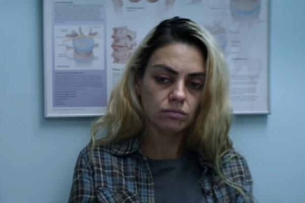 FOTOGRAFIJE OMILJENE GLUMICE UZNEMIRILE JAVNOST: Puna ožiljaka i modrica, a nekada je važila za NAJLEPŠU!