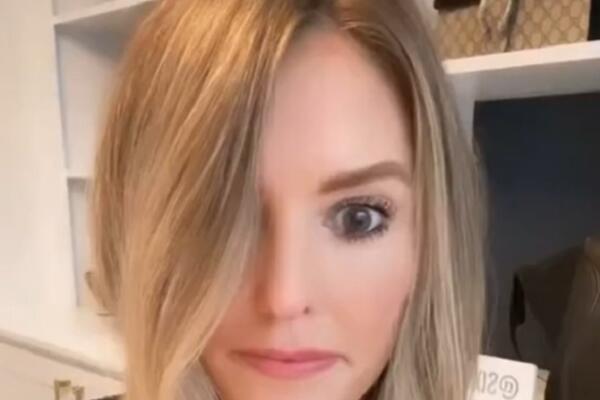 OTIŠLA NA BOTOKS, KADA SE POGLEDALA U OGLEDALO SLOŠILO JOJ SE: Deo lica ISKRIVLJEN (VIDEO)