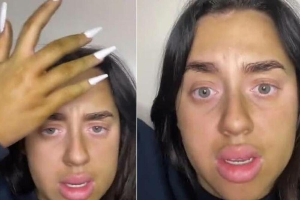 IZGLEDAM KAO ŠREK! BRITANKA KORISTILA KOZMETIKU KOJOJ JE PROŠAO ROK TRAJANJA: "Neka mi neko pomogne" (VIDEO)