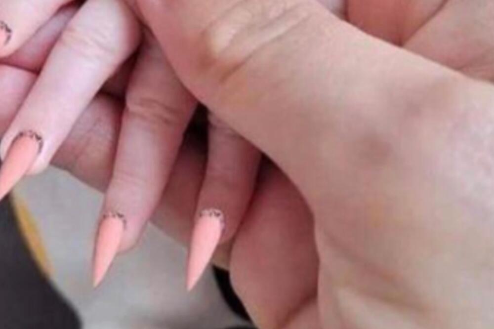 DOKTOR OTKRIO ŠTA SE DEŠAVA DEVOJČICAMA SA NOKTIMA: Majke ih vode na gel lak pa mi ih dovode u ovakvom stanju