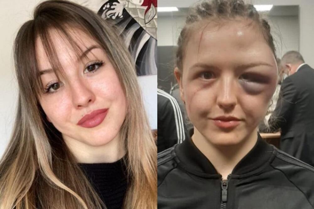 JEZIVO: Nemačkoj bokserki rivalka deformisala lice udarcima - i to prljavim! NE LIČI NA SEBE posle borbe! (FOTO)