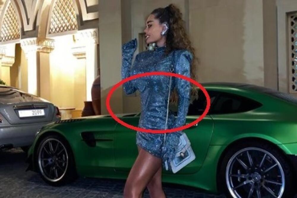 ANA KORAĆ IZVRŠILA OPERACIJU SMANJENJA STRUKA I ISKEŠIRALA VRTOGLAVIH 7.000 EVRA: Izvađen joj poslednji par rebara!