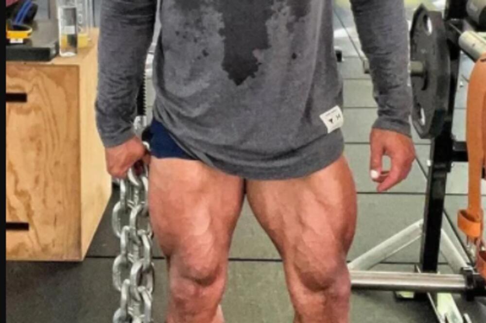 PLANETA JE OSTALA BEZ DAHA: Čuveni glumac pokazao sliku NOGU, ovo je STRAŠNO! (FOTO)