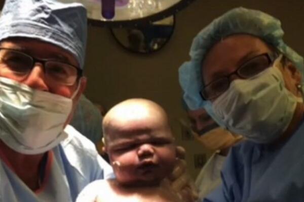 PORODILI ŽENU, A KAD SU UGLEDALI BEBU OSTALI SU BEZ TEKSTA: Ovo nije VIĐENO! (VIDEO)