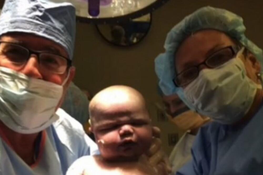 PORODILI ŽENU, A KAD SU UGLEDALI BEBU OSTALI SU BEZ TEKSTA: Ovo nije VIĐENO! (VIDEO)