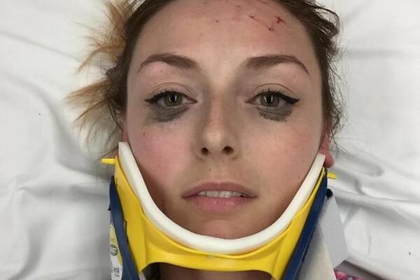 OBJAVILA JE FOTOGRAFIJU POSLE TEŠKE SAOBRAĆAJNE NESREĆE: Ceo svet priča o jednom DETALJU na njoj (FOTO)