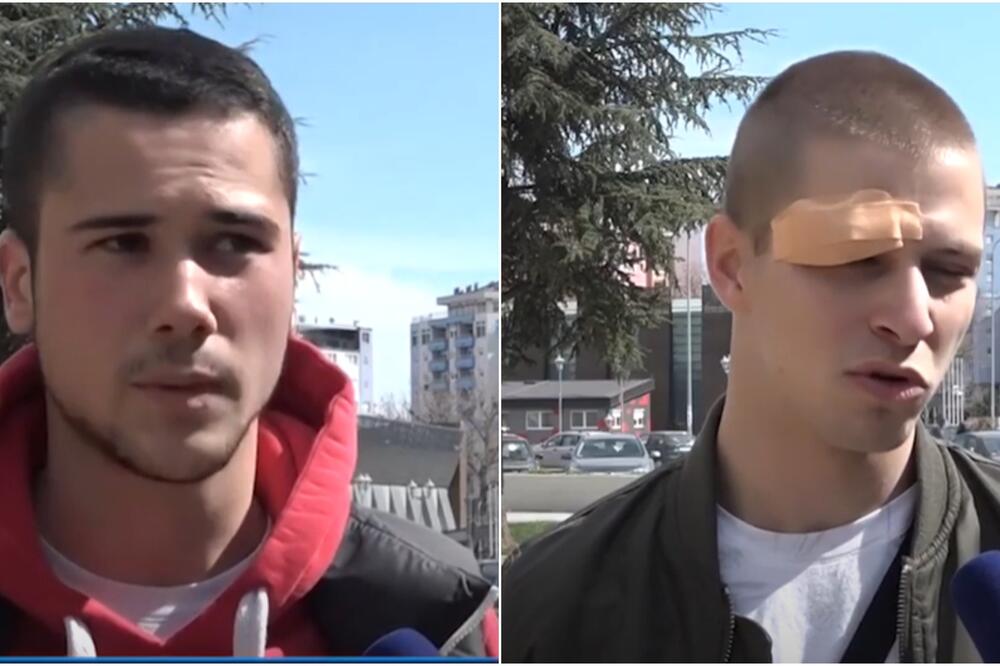 POLICIJA IZ KOSOVSKE MITROVICE POZIVA: Javite odmah ako prepoznate napadače na srpske mladiće! (VIDEO)