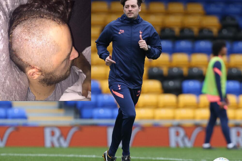 FILMSKA PRIČA Pre četiri godine mu pukla lobanja, JEDVA ostao živ, sada je najmlađi menadžer Premijer lige!