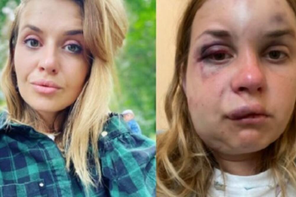 VODITELJKU ANASTASIJU PRED SINOM U VOZU PRETUKAO MANIJAK: Pokušao i da je siluje, a onda se dogodio OBRT!