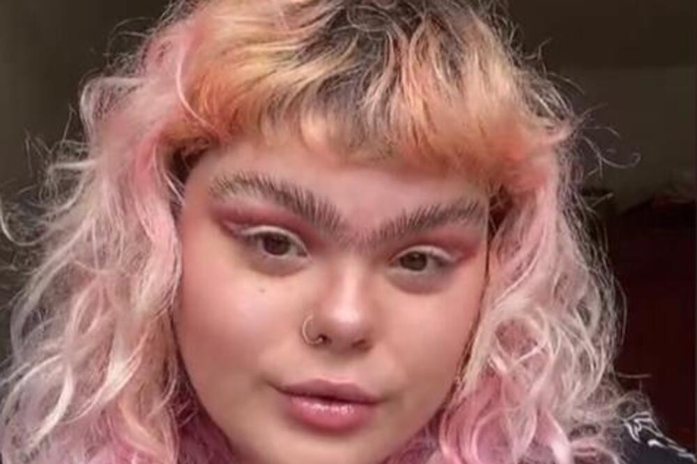 ZBOG SPOJENIH OBRVA SU JE ZVALI GORILOM, A SADA IH PONOSNO PUŠTA: "Želim da se svi dobro osećaju u svojoj koži"!