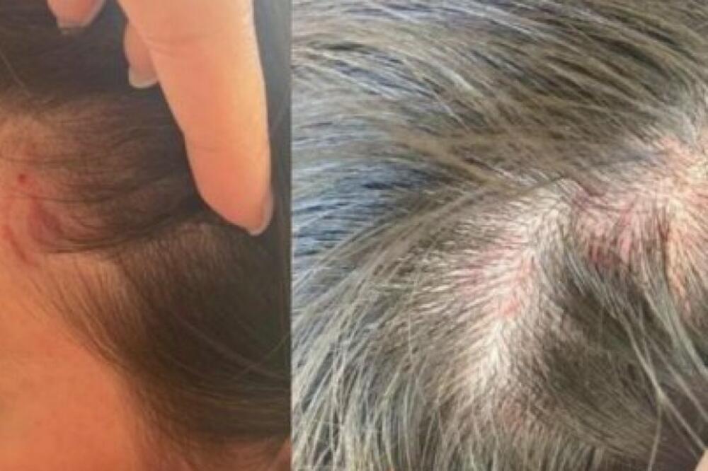 SKANDAL U BEOGRADSKOM AUTOBUSU! Kontrolorka TUKLA, ČUPALA i DRALA SE na putnicu, ostali samo gledali (FOTO)