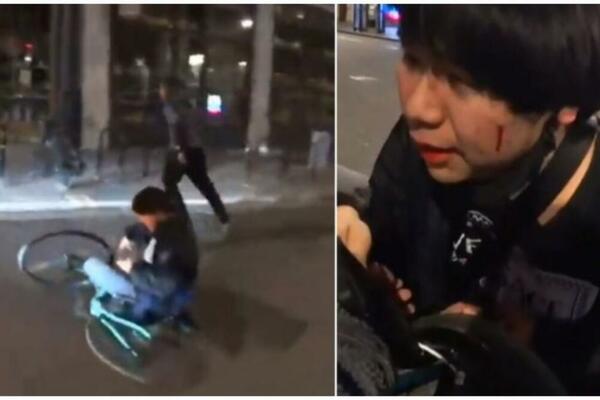 NAPAD NA STUDENTA U LONDONU PRENOŠEN UŽIVO: Snimak ledajte na svoju odgovornost (VIDEO)