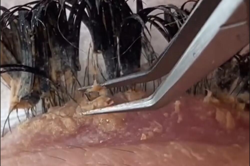 VODITE RAČUNA! KOZMETIČARKA POKAZALA ŠTA SE DEŠAVA AKO NE ČISTITE EKSTENZIJE TREPAVICA: Ovo je GROZNO! (VIDEO)