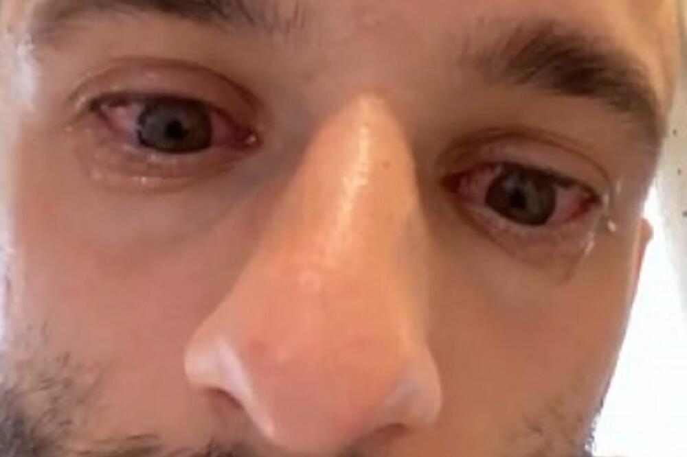 KAO KOD ĐAVOLA: Fudbaler Intera ili je NADUVAN KAO ZVER ili mu je nešto upalo u oči!