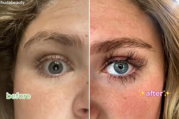 NAMAZALA JE TREPAVICE SREDSTVOM ZA RAST, I ONE SU BAŠ PORASLE: Ipak 1 STVAR joj se desila, HOROR, PRESELO JOJ JE!