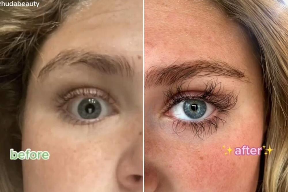 NAMAZALA JE TREPAVICE SREDSTVOM ZA RAST, I ONE SU BAŠ PORASLE: Ipak 1 STVAR joj se desila, HOROR, PRESELO JOJ JE!