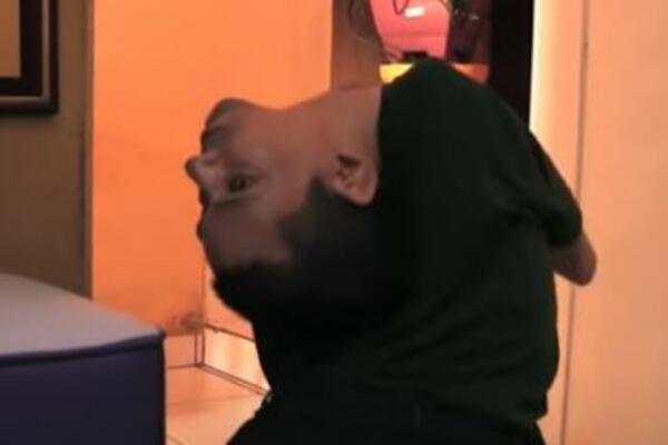 OVAJ ČOVEK JE ROĐEN SA GLAVOM KOJA MU STOJI NAOPAKO: Svaki momenat u životu je velika BORBA! (VIDEO)