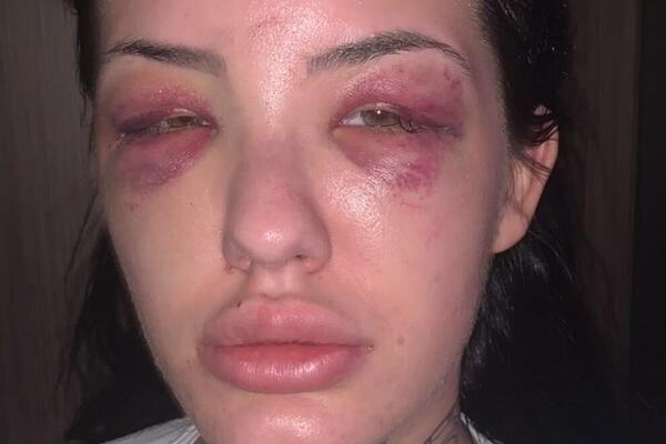 RASKRINKAN DEČKO KOJI JE BRUTALNO PRETUKAO SRPSKU STARLETU: Tvrdi se da ima još ŽRTAVA, detalji užasni! (FOTO)