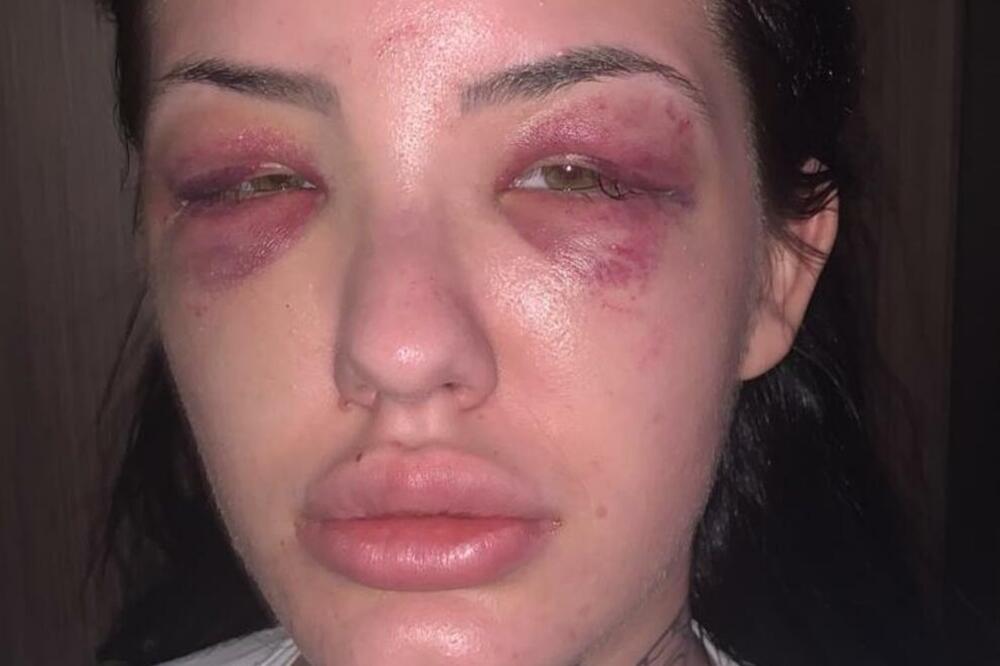 RASKRINKAN DEČKO KOJI JE BRUTALNO PRETUKAO SRPSKU STARLETU: Tvrdi se da ima još ŽRTAVA, detalji užasni! (FOTO)