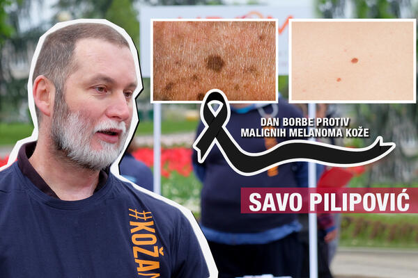 BIO SAM OTPISAN, NISAM MISLIO DA ĆU DOŽIVETI 50. ROĐENDAN: Ispovest Save Pilipovića koji se bori protiv melanoma