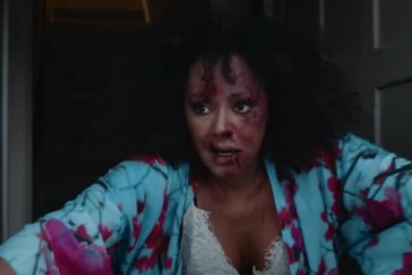 JEZIVO! POZNATA PEVAČICA SVA U MODRICAMA, KRVAVA I BRUTALNO PRETUČENA: Uznemirujući video nasilja ZGROZIO SVET!