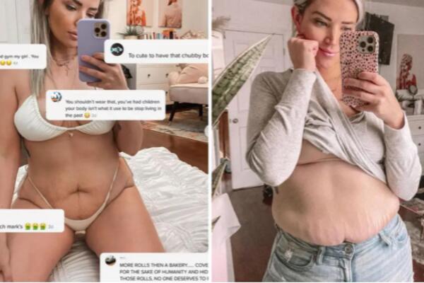 HRABRA ŽENA! Pokazala kako joj TELO izgleda nakon ČETIRI TRUDNOĆE, naišla na razne komentare (FOTO)