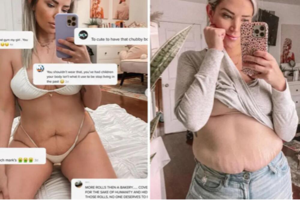 HRABRA ŽENA! Pokazala kako joj TELO izgleda nakon ČETIRI TRUDNOĆE, naišla na razne komentare (FOTO)