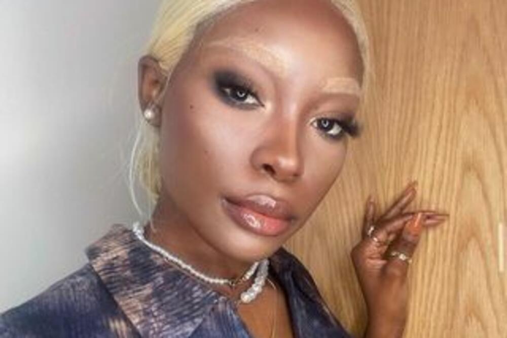 EKSPERIMENT KIM KARDAŠIJAN POSTAO GLOBALNI TREND! MNOGE JE ŠOKIRALA: Amerikanci postali ZALUĐENI istim! (FOTO)