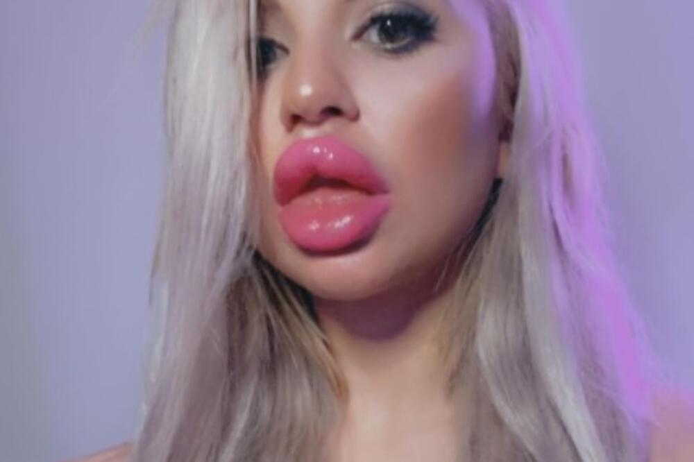 OSMO SVETSKO ČUDO! Na transformaciju potrošila 3 MILIONA DINARA i postala tinejdžerka sa NAJVEĆIM SILIKONIMA (FOTO)