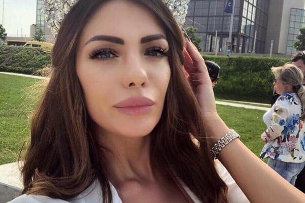 SVOJU LEPOTU JE ZAMENILA ESTETSKIM OPERACIJAMA: Doktor više NEĆE DA JE VIDI, uradila je i MAČKASTE OČI! (FOTO)