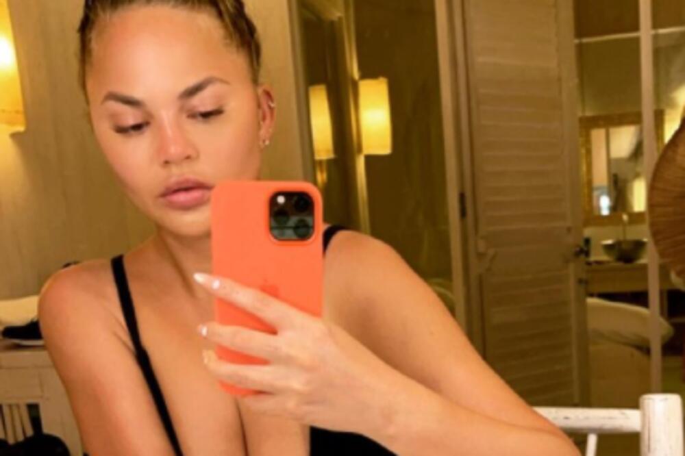 ATRAKTIVNA MANEKENKA SE SKINULA, A ONDA SEBE OBRUKALA OPISOM: Telo joj se DEFORMISALO, morala da reaguje! (FOTO)