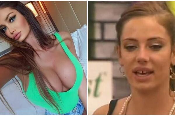 SORAJINA EVOLUCIJA!ULOŽILA JE U SEBE BLIZU 100.000 EVRA DA BI BILA LEPŠA! Nova fotka ZGRANULA, toliko PLASTIKE?