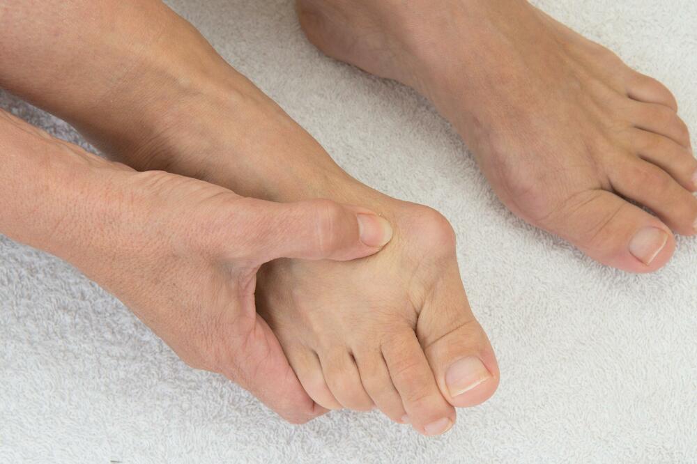 FIZIOTERAPEUT OTKRIO KAKO DA ISPRAVITE ČUKLJEVE I TO ZA MALE PARE: Kada vidite KOLIKO JE DOBRO odmah ćete kupiti