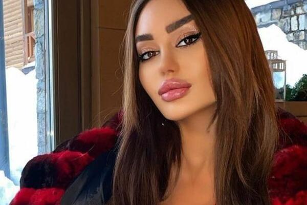 ANA KORAĆ IZAŠLA NA ULICU BEZ BRUSHALTERA! (FOTO)