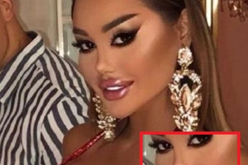 "KAKO DIŠE SA OVAKO USKIM NOSEM?" Tviteraši OSULI PALJBU po Ani Korać, baš su ŽESTOKI: Smeta im njena "PLASTIKA"!