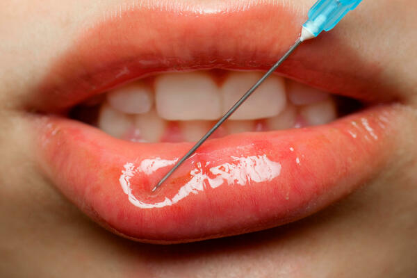 DA LI PODRŽAVATE ESTETSKU HIRURGIJU? Pitanje koje je podelilo društvene mreže