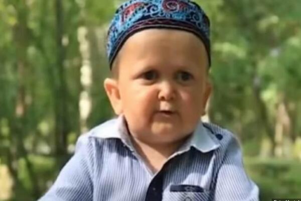 DETE ČOVEK KOJI JE OSVOJIO SRCA SVIH: "Mini Kabib" ima 18 godina i boluje od čudnog poremećaja (VIDEO)