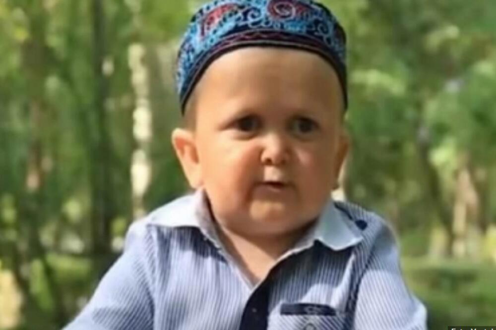 DETE ČOVEK KOJI JE OSVOJIO SRCA SVIH: "Mini Kabib" ima 18 godina i boluje od čudnog poremećaja (VIDEO)