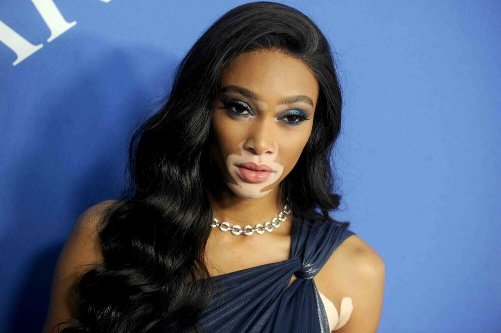 ZBOG RUŽNIH KOMENTARA NA RAČUN IZGLEDA HTELA JE DA SE UBIJE: Danas je NAJPLAĆENIJA svetska manekenka!