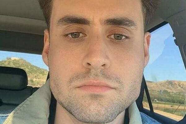 OGAVNO! Koristio je cimerov brijač, kada vidite šta mu se pojavilo na bradi NIKADA ništa nećete pozajmiti (VIDEO)