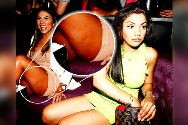 SANDRA AFRIKA VIŠE NIJE NAJZODNIJA PEVAČICA! DOKAZ ŠOKIRA: Iz mini haljine blješti CELULIT!