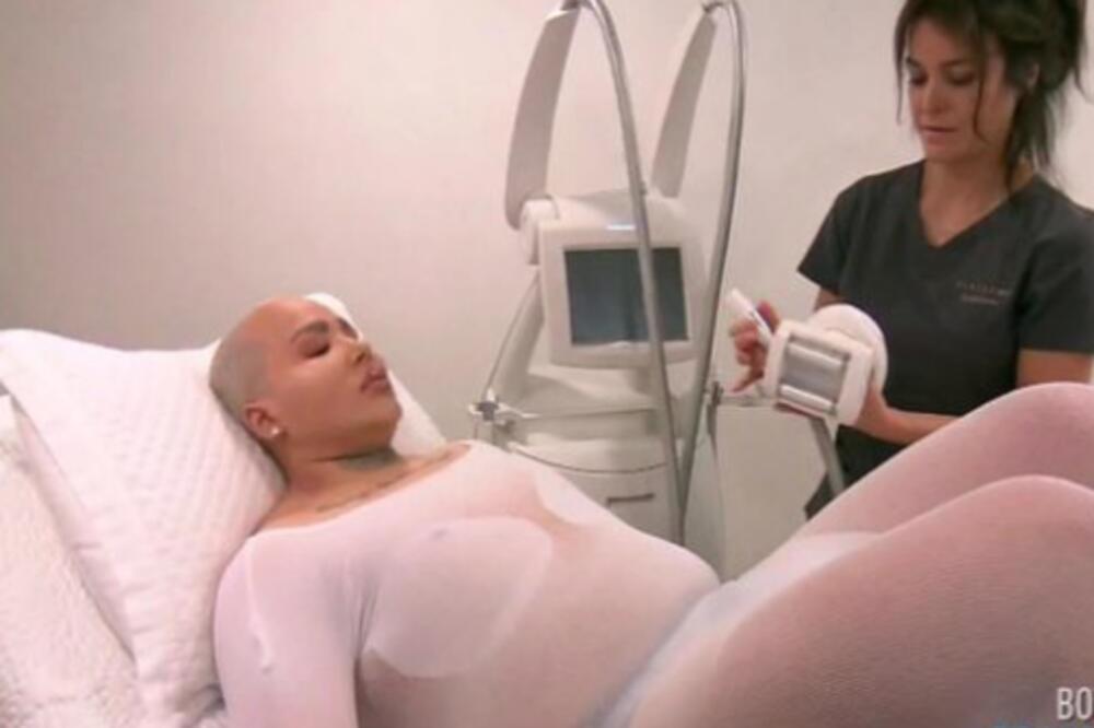 HTEO JE DA IZGLEDA KAO KIM KARDAŠIJAN I UMALO GA TO ODVELO U SMRT: Promenio potpuno lični opis i BOLESNO SE IZMENIO