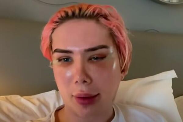 INFLUENSER NA UDARU KRITIKA, PONOVO SE OPERISAO: Tvrdi da je "TRANSRASAN" jer sada ima "korejske oči"! (FOTO/VIDEO)