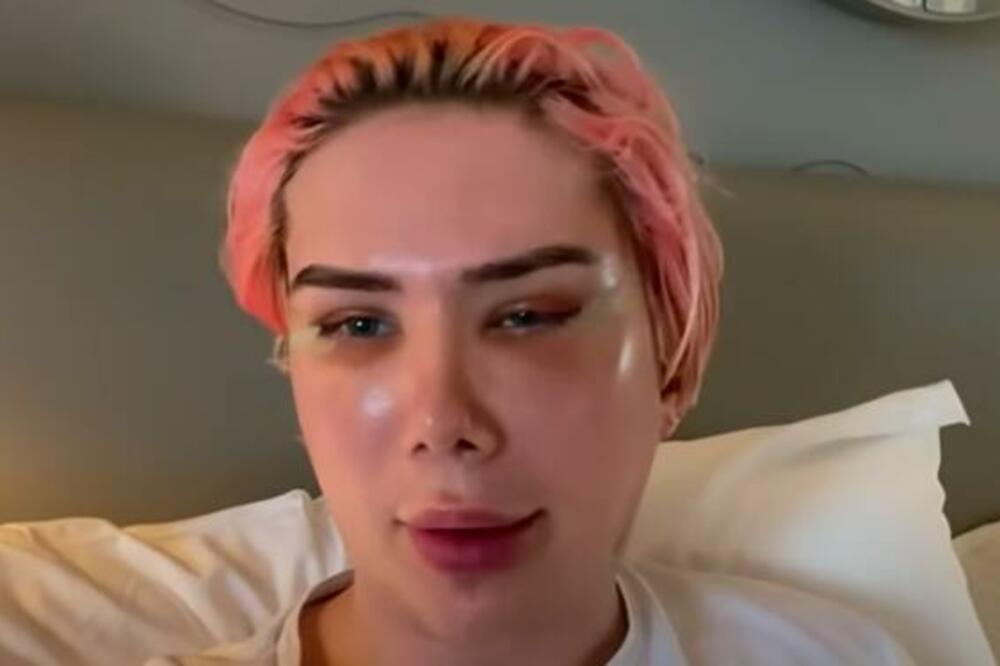 INFLUENSER NA UDARU KRITIKA, PONOVO SE OPERISAO: Tvrdi da je "TRANSRASAN" jer sada ima "korejske oči"! (FOTO/VIDEO)