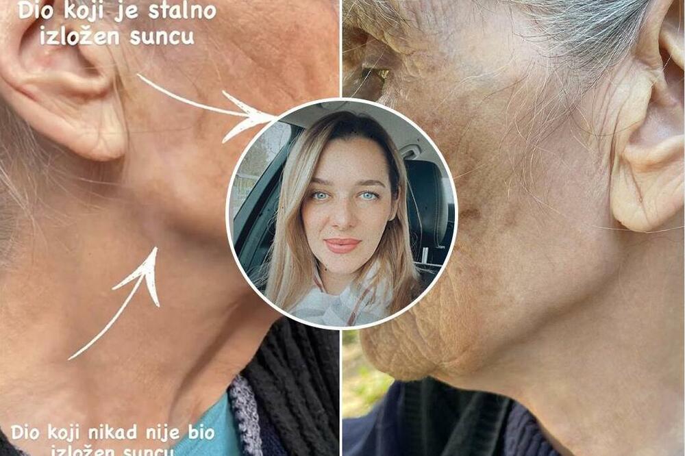 DR ZLATA POKAZALA KAKO IZGLEDA LICE NJENE BAKE, SVI SU U ČUDU: Razlika je enormna, samo zbog jedne stvari! (FOTO)